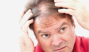 hair loss